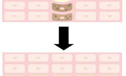 メラニンのない肌