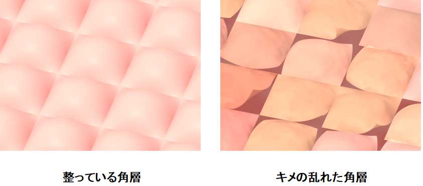 キメの乱れた角層