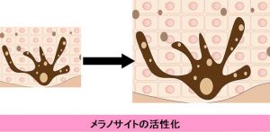 メラノサイトの活性化
