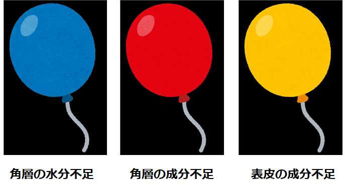 表皮シワの風船理論