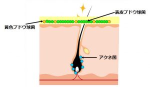 細菌バリア