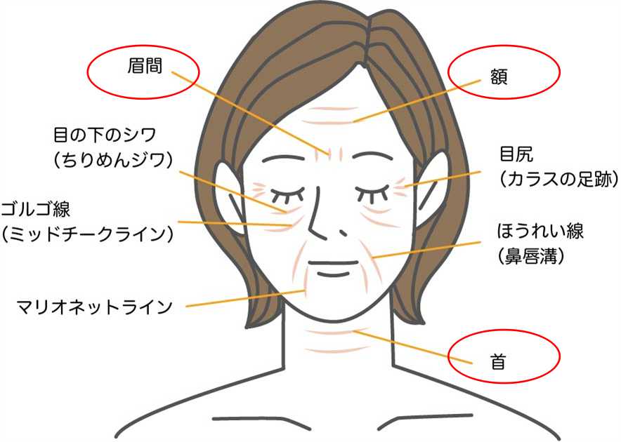 表情シワ